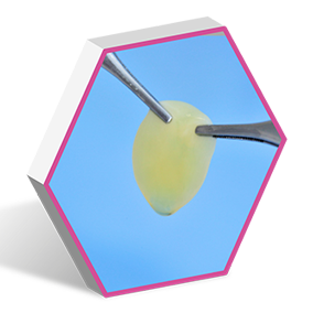 Endoret prgr clot