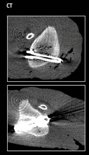 Magnezix Imaging Comparison