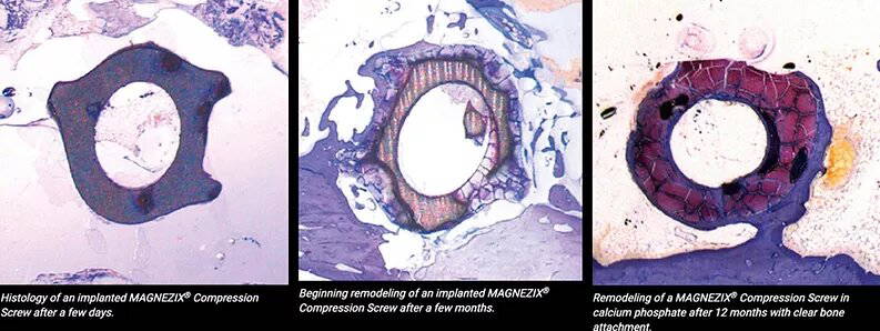 Magnezix Process